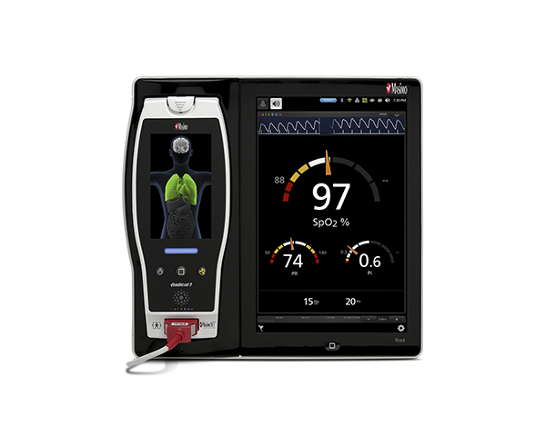 Root patient monitor with Radical-7 docked.