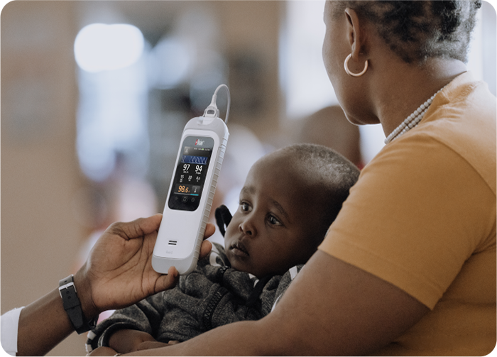 Black healthcare uses a Masimo Rad-G with Temperature device to check a black baby's temperature while held by a caregiver.